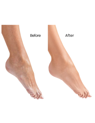 transparent-Photoroom - 2026-02-03T111009.371