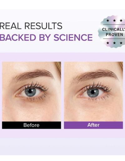 transparent-Photoroom - 2026-03-11T132621.237